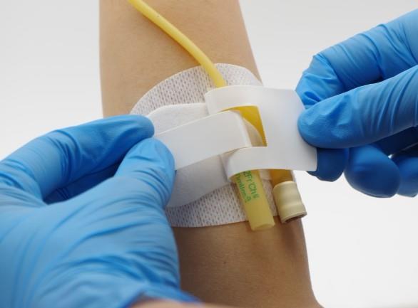 Foley Catheter Fixing Dressing Device